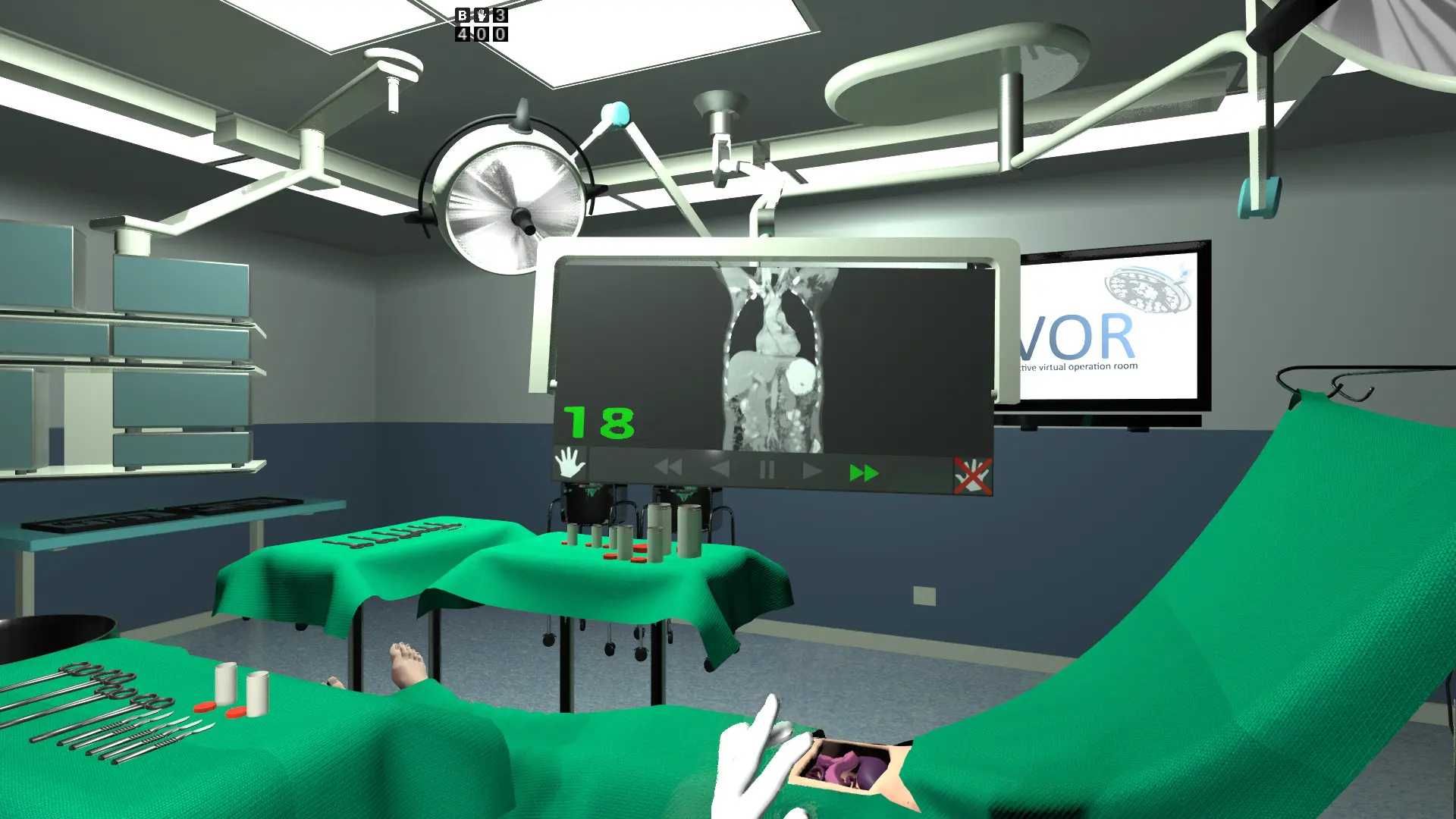 Virtual Reality for User-Centered Design and Evaluation of Touch-free Interaction Techniques for Navigating Medical Images in the Operating Room